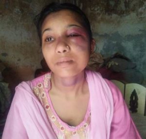 हरिद्वार: विवाहिता को पीटा और जंगल में फेंक दिया, पति सहित ससुरालियों पर मुकदमा