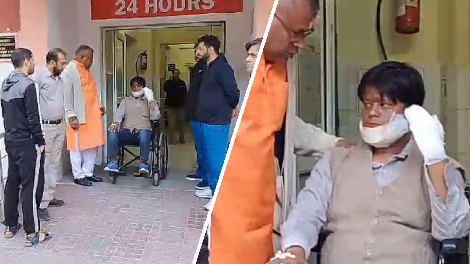 हरिद्वार में चाइनीज मांझा: पत्नी के साथ जा रहे युवक के चेहरा, अंगूठा कटा, हायर सेंटर रैफर