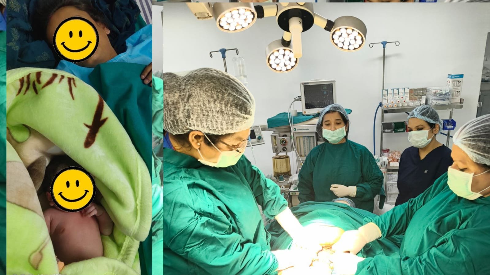 अच्छी खबर : महिला अस्पताल की एमसीएच विंग में गूंजी किलकारी, अत्याधुनिक आपरेशन थिएटर में हुआ बच्चे का जन्म, दोनों स्वस्थ